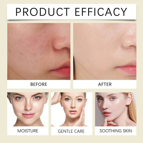 Whipped Beef Tallow Honey Balm Moisturizing Hydrating Face Cream Body Lotion Moisturizing Nourishing gentle repairing skincare